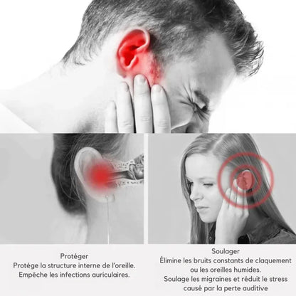 Bebird EarSight Plus Ohrreiniger